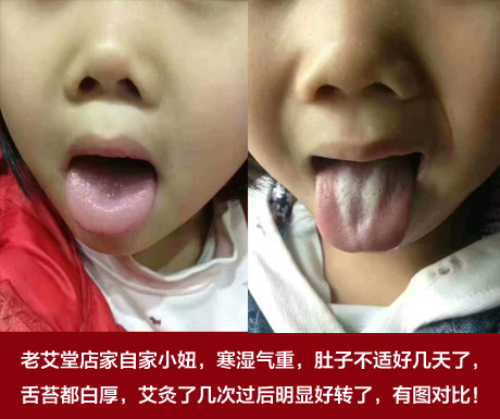 老艾堂古方理疗 老艾堂古方理疗