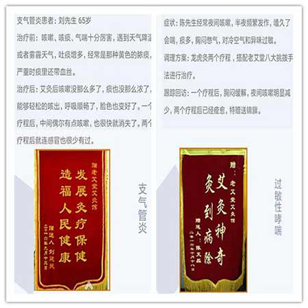 老艾堂龙虎灸调理气管炎、哮喘案例