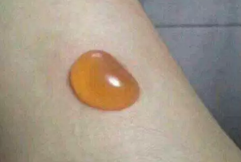 老艾堂艾灸养生